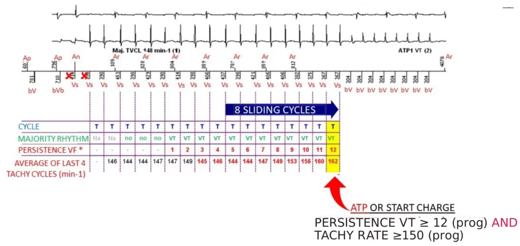 VT counting: 8 sliding cycles give a VT majority, VT persistence reaches 12 with a tachycardia rate of at least 150 bpm and ATP is delivered