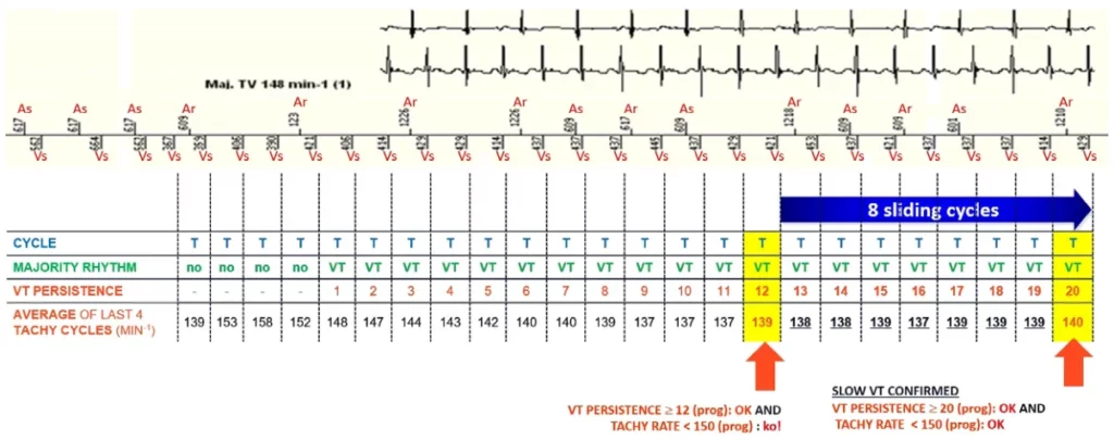 Slow VT counting: the VT majority persists but the rate falls in the Slow VT zone; Slow VT persistence reaches 20 cycles and the episode is recorded without therapy
