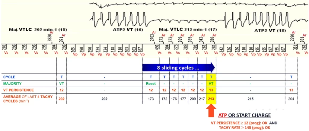 Redetection in the VT zone after ATP: persistence kept at 12, a new VT majority triggers the second programmed VT therapy