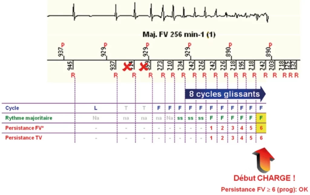 Exemple de comptage d’une FV : majorité FV après 6 cycles, persistance FV à 6 et début de la charge des condensateurs