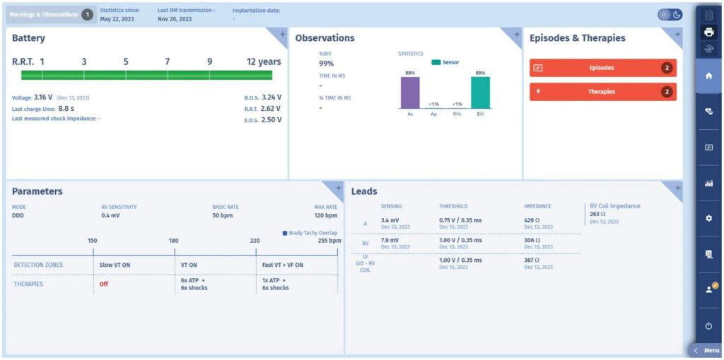Counting in the VT zone: MicroPort ICD tracing (EGM)
