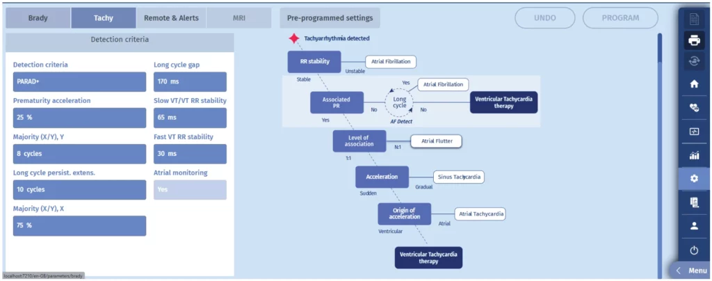 MicroPort programmer, Tachy tab, Detection criteria screen displaying the PARAD+ discrimination algorithm