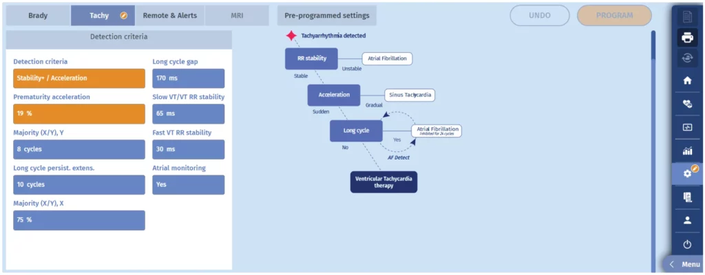 Programmer screen after switching to single-chamber discrimination (Stability+/Acceleration) because of atrial lead dysfunction