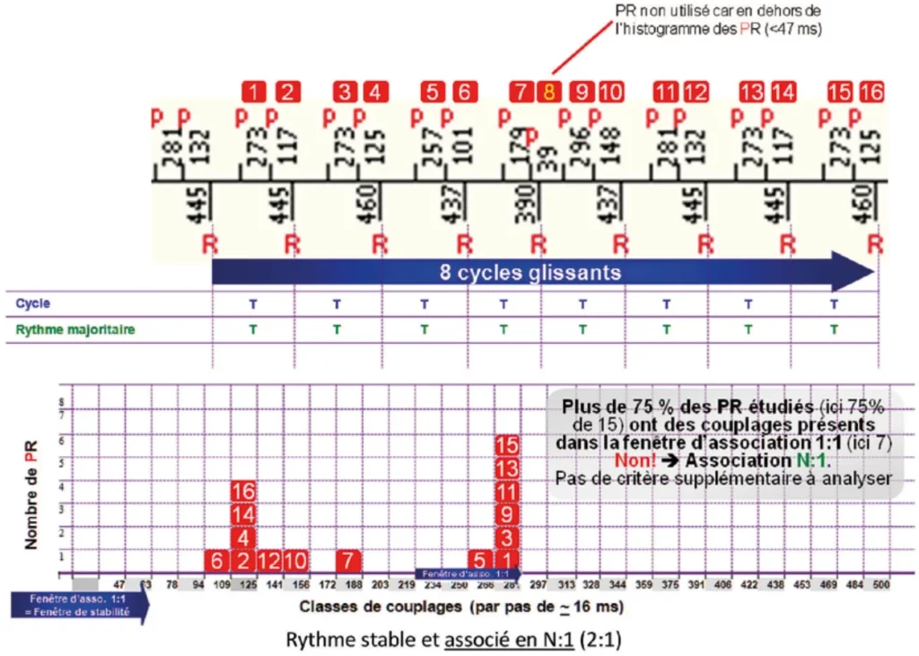 Histogramme des délais PR : moins de 75 % des PR dans la fenêtre d’association 1:1, rythme stable et associé en N:1 (2:1)