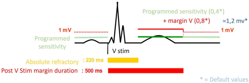 Sensitivity after ventricular pacing: 220 ms absolute refractory period, programmed sensitivity plus the V margin until 500 ms, then 1 mV
