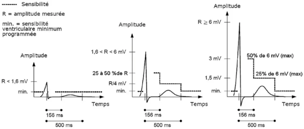 Contrôle automatique de la sensibilité ventriculaire pour des ondes R inférieures à 1,6 mV, entre 1,6 et 6 mV et supérieures à 6 mV