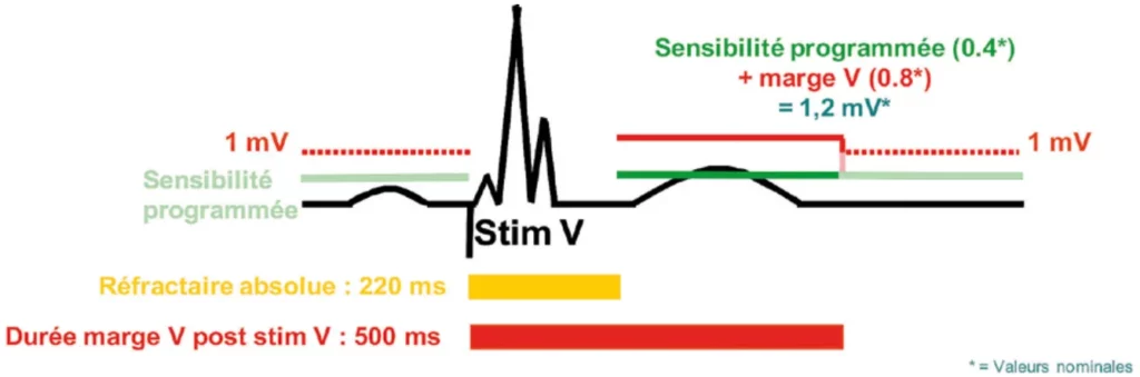 Sensibilité après stimulation ventriculaire : réfractaire absolue de 220 ms, sensibilité programmée plus marge V jusqu’à 500 ms, puis 1 mV