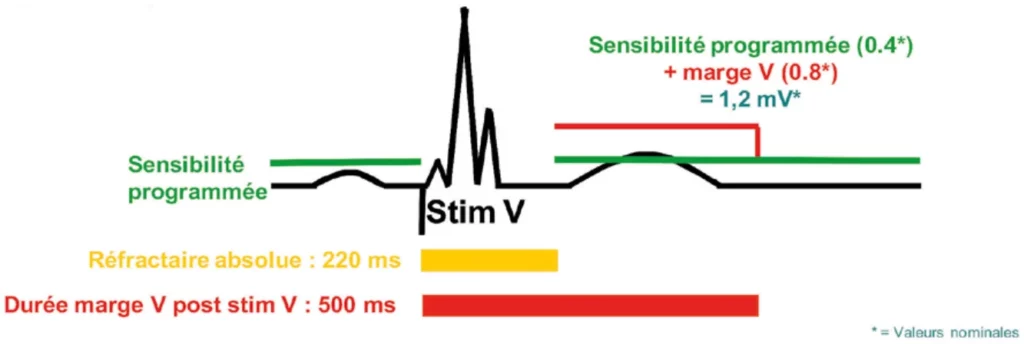 Sensibilité après stimulation ventriculaire avec un cycle court sur les six derniers cycles : retour à la sensibilité programmée après 500 ms