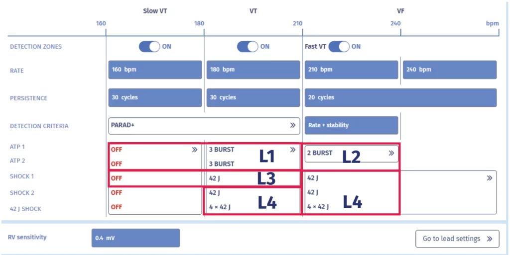 MicroPort ICD programmer screen of the tachycardia zones and therapies, with the levels of aggressiveness L1 to L4 outlined
