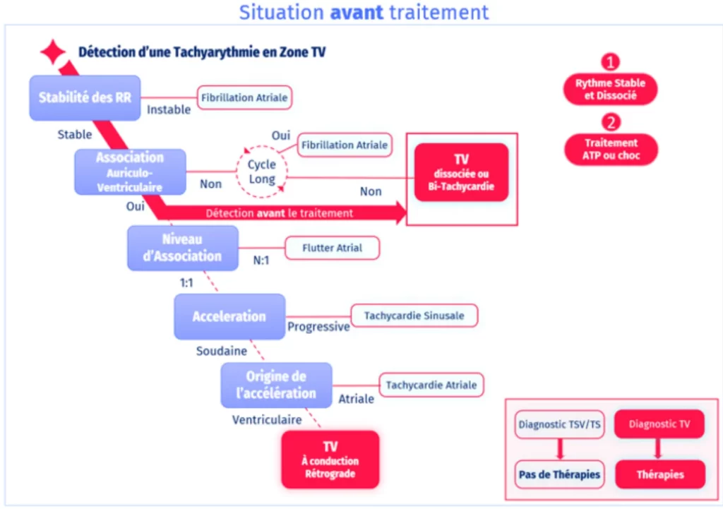 Situation avant traitement : arbre de décision PARAD+, un rythme stable et dissocié est classé TV et traité par ATP ou choc