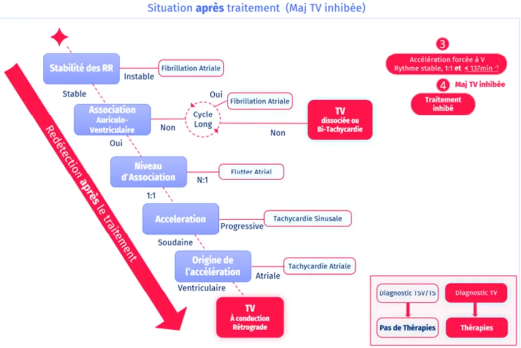 Situation après traitement : accélération forcée à V, rythme stable 1:1 inférieur à 137 min-1, majorité TV inhibée