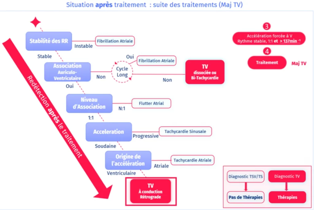Situation après traitement : accélération forcée à V, rythme stable 1:1 supérieur à 137 min-1, suite des traitements (majorité TV)