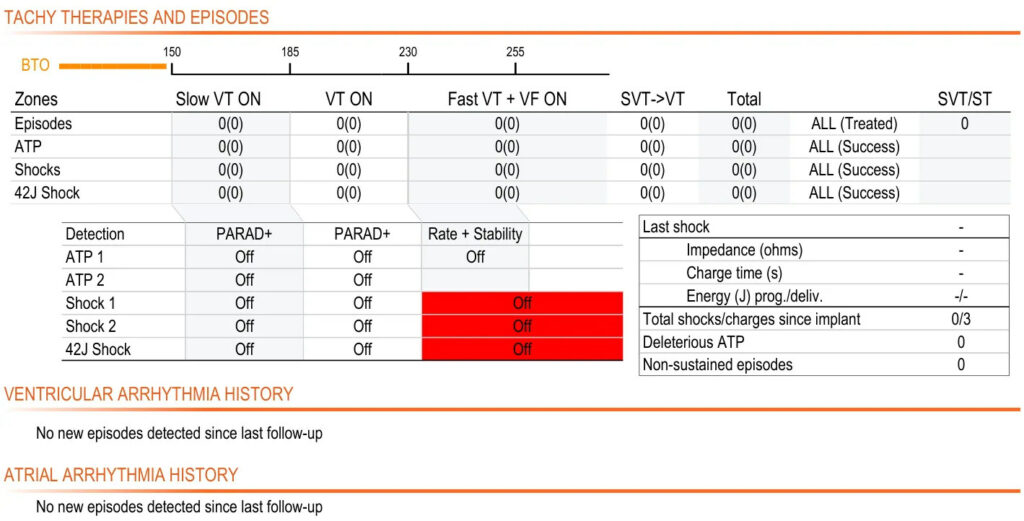 Chocs désactivés : tracé de DAI MicroPort (EGM)