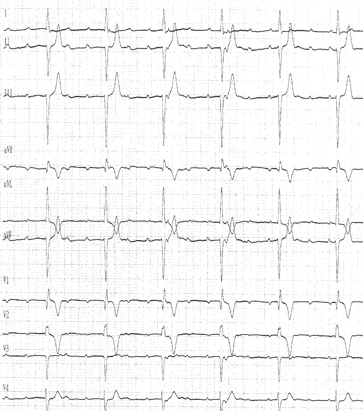 trace-1-9-ecg
