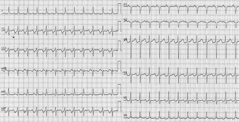 trace-7-9-ecg