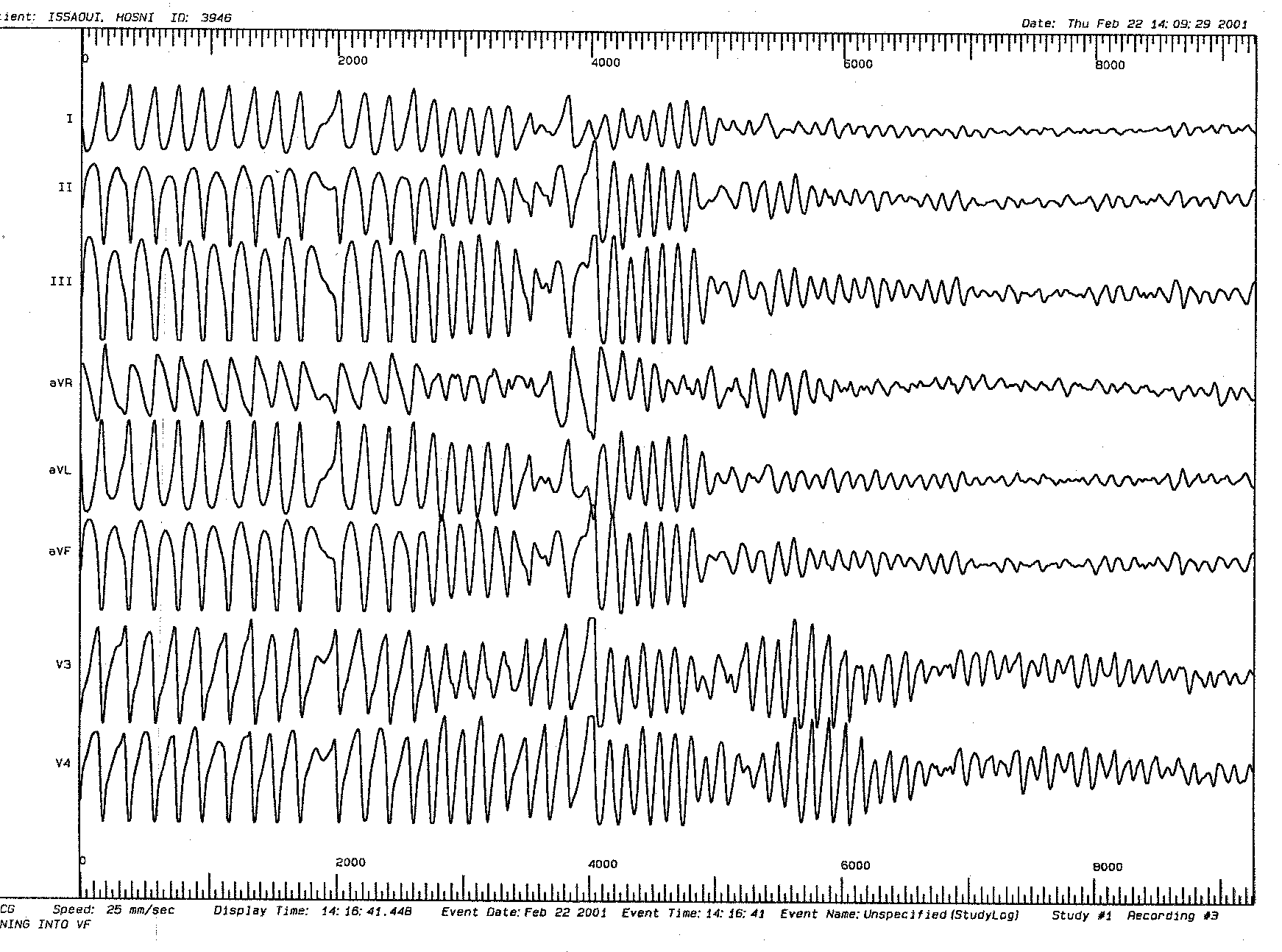 trace-7-12-ecg2