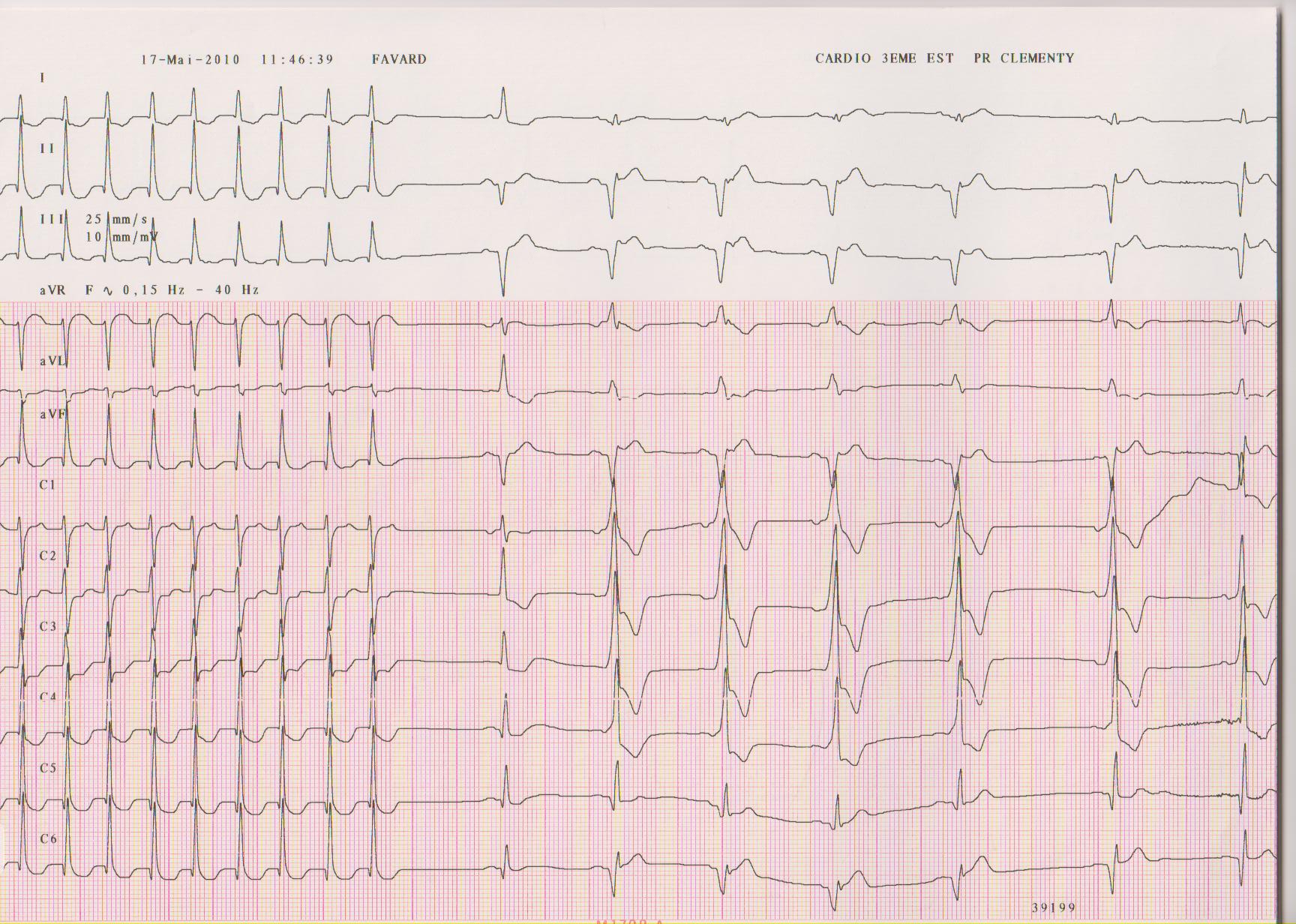 trace-7-7-ecg4