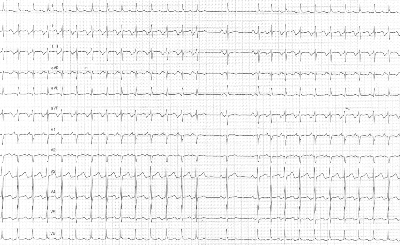trace-7-9-ecg2