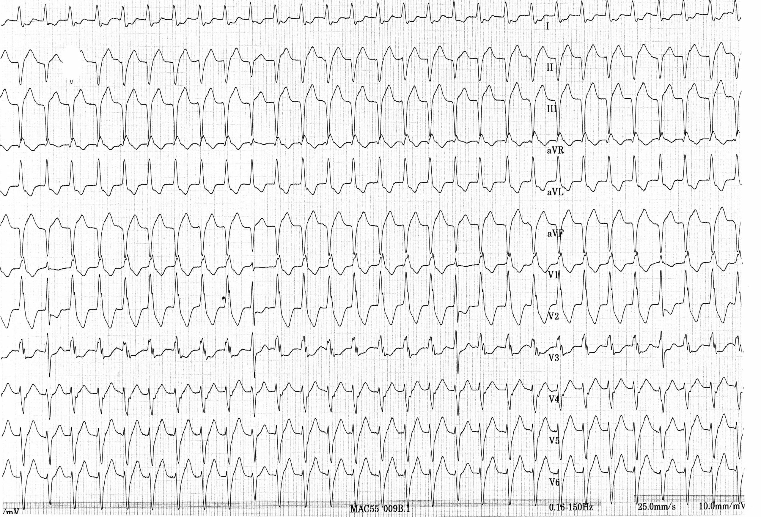 trace-8-8-ecg7
