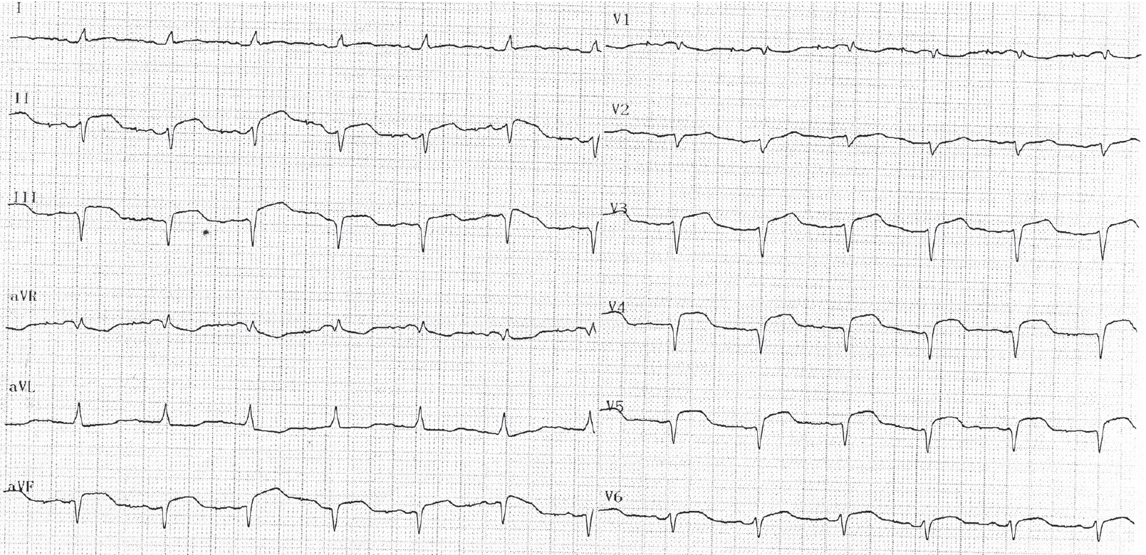 trace-8-9-ecg6