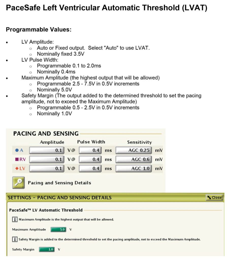 PaceSafe LV automatic threshold (LVAT): the programmable values and the programmer screen