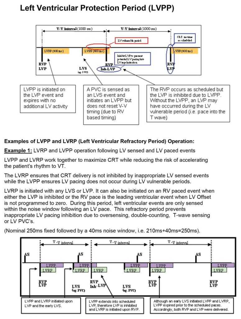 Left ventricular protection period (LVPP): after an LV sensed or paced event the LV is not paced for a while (nominal 400 ms); an LV pace due within it is inhibited (Inh-LVP) and the RV is paced as scheduled
