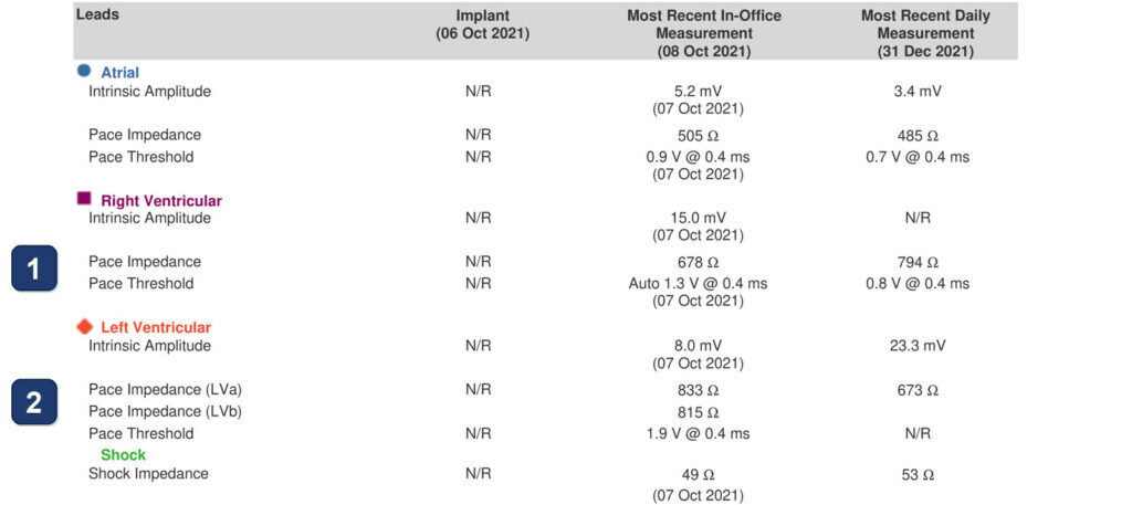 LV pacing impedance climbing after implant: Boston Scientific CRT tracing (EGM)
