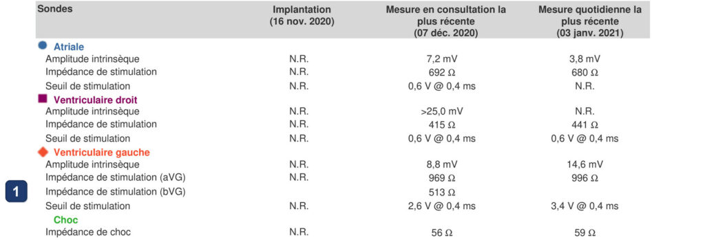LV threshold and impedance rising in the first weeks after implant: Boston Scientific CRT tracing (EGM)